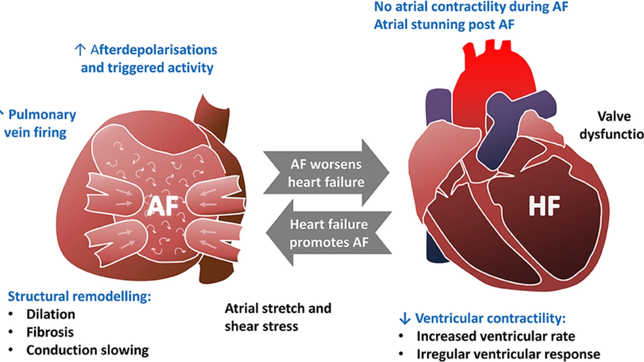 Enalapril and Heart Failure: What You Need to Know
